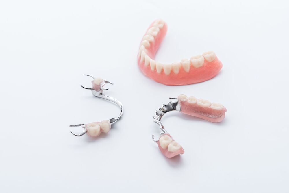 Implant Retained Partial Dentures