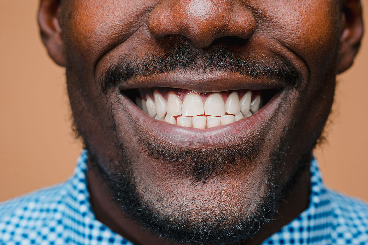 Smiling man with healthy teeth after dental surgery recovery